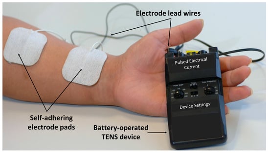 daneen dhoore recommends electrostimulation torture pic