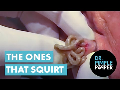 arif aga recommends Dr Squirt