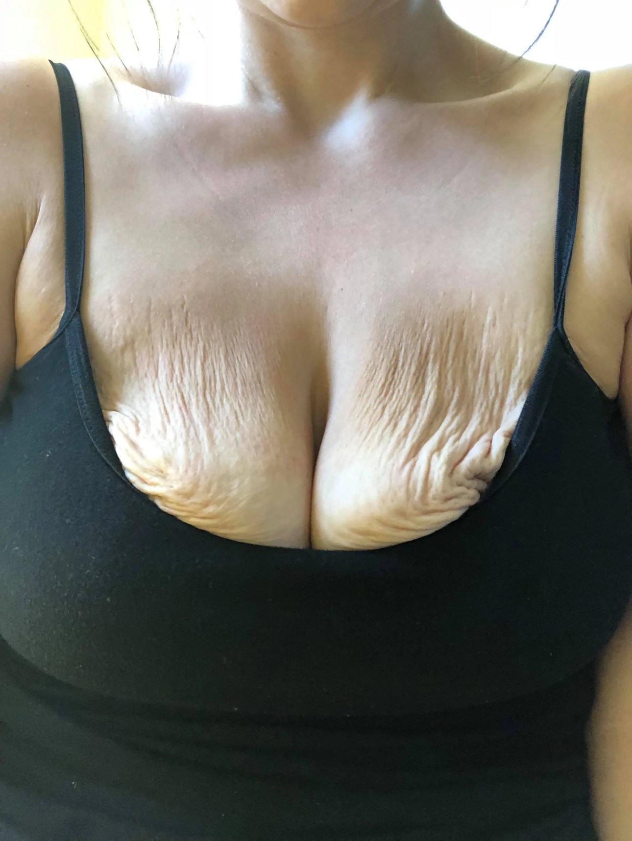 alexandra bock recommends Huge Droopy Tits