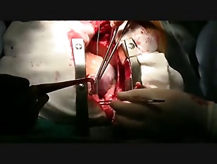 betsy handley share surgical porn photos