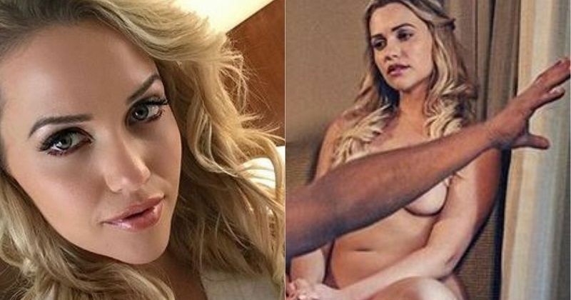 abby shows recommends mia malkova after surgery pic