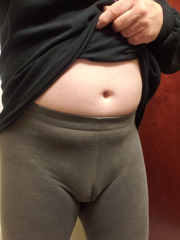 accidental cameltoe