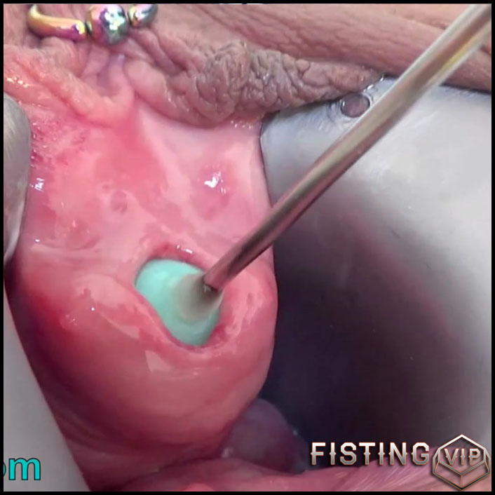 chris grimaldi add fisting urethra photo