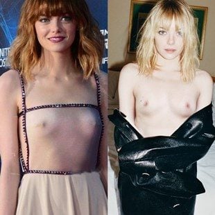 barbara clarkson recommends Naked Pictures Of Emma Stone