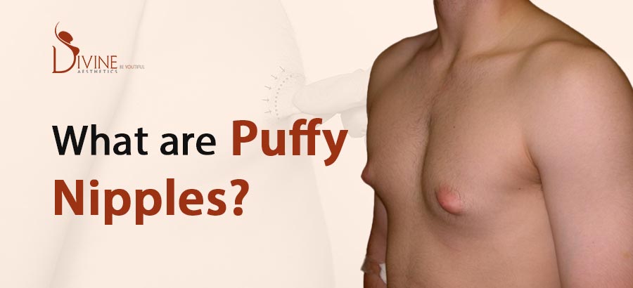 bac dace recommends Puffy Tittys